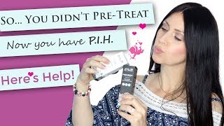 So You have PIH  Chemical Peel Help  Dark Skin  Hyperpigmentation Treatment  Pretreatment [upl. by Eelah445]