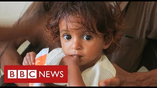 Yemen facing world’s “worst famine in decades”  BBC News [upl. by Ahsinrad]