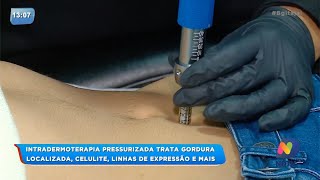 BG  Intradermoterapia pressurizada trata gordura localizada [upl. by Ainoloppa]