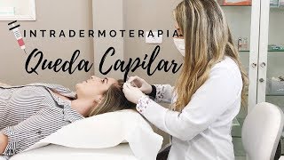 Meu tratamento capilar para queda de cabelo  Intradermoterapia Capilar [upl. by Derry]