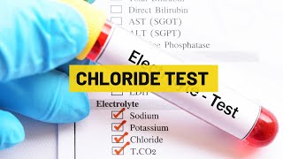 Chloride Test  My Lab Solution [upl. by Adnilram316]