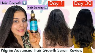 How I Went From Thin To Thick Hair In 30 Days  Pilgrim Advanced Hair Growth Serum Review [upl. by Rowe]