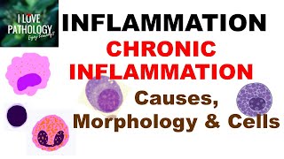 Clinical features of inflammation [upl. by Eiuqnom]