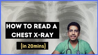 Bronchiolitis treatment  Respiratory system diseases  NCLEXRN  Khan Academy [upl. by Tai108]