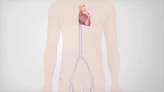 Radiofrequency Catheter Ablation [upl. by Marcellus]