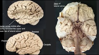 Lateral sulcus [upl. by Adelia]