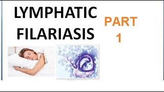 Parasitology 221 a Wuchereria Bancrofti Filariasis Filarial worm Elephantiasis Culex Microfilaria [upl. by Crooks]