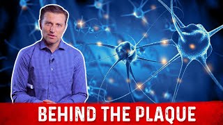 What is Plaque and How to Remove it Explained By Dr Berg [upl. by Brita755]