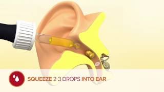 How to use Otex Olive Oil Ear Drops [upl. by Eineeuq212]