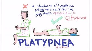 PlatypneaOrthodeoxia Syndrome [upl. by Patrich75]