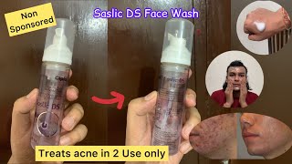 Saslic DS Face Wash Review  Saslic Foaming Face Wash Review [upl. by Tavey307]