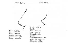 Get a Higher Nose Bridge FAST ―∎𝘢𝘶𝘥𝘪𝘰 𝘢𝘧𝘧𝘪𝘳𝘮𝘢𝘵𝘪𝘰𝘯𝘴  Full Thin Nose [upl. by Maybelle]