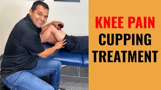 Knee Pain Treatment Using Breakthrough Electric Cupping Tool [upl. by Crutcher]