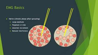 Polymyalgia Rheumatica  Signs amp Symptoms Diagnosis and Treatment [upl. by Pass]