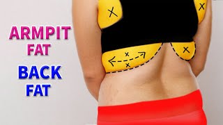 5 Simple Exercise to burn Back amp Armpit Fat [upl. by Lev]