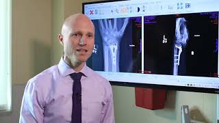 Broken Wrists Fracture Types Treatment Options amp Recovery  Dr Froelich [upl. by Anirhtak]