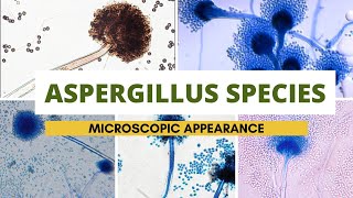 Aspergillus species microscopic appearance  Aspergillus identification Clear explanation [upl. by Temp]