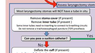 Emergency laryngectomy management [upl. by Schnapp655]