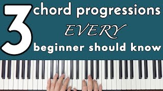 Common Chord Progressions Every Beginner Should Know [upl. by Eedeed723]