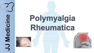 Myocarditis Causes Signs and Symptoms Diagnosis Treatment [upl. by Yliram]