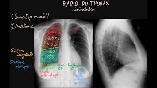 Radio du thorax  Introduction  Partie 1  Docteur Synapse [upl. by Munn]