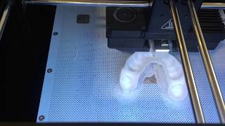 Fabrication prothèse dentaire avec Imprimante 3D [upl. by Ymrej]