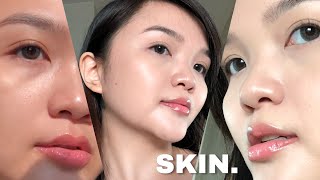 How to tell when your SKIN BARRIER IS DAMAGED Dr Dray [upl. by Yecnay]