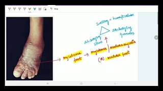 Subcutaneous Deep Mycoses  Microbiology  Image based discussion [upl. by Anilos]