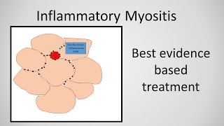 Syndrome Myopathy [upl. by Annod]