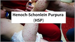 HenochSchonlein Purpura HSP [upl. by Jsandye]