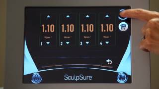 SculpSure Patient Treatment Experience [upl. by Coats617]