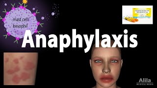 Anaphylaxis Animation [upl. by Annalla]