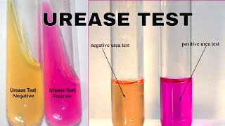 Urea Hydrolysis Urease Test [upl. by Colver781]