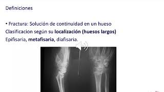 GENERALIDADES DE ORTOPEDIA Y TRAUMATOLOGIA [upl. by Yssirc]