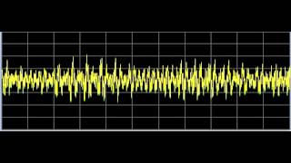 Diabetes 1  Rife Frequencies [upl. by Aistek]