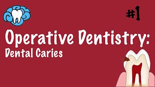 Operative Dentistry  Dental Caries  INBDE ADAT [upl. by Meehar]