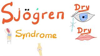 Sjögren Syndrome  Dry eyes Dry mouth Arthritis  Rheumatology Series [upl. by Ettener]