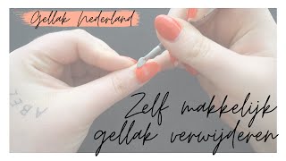 GELLAK VERWIJDEREN  Uitgebreide uitleg  Gellak Nederland [upl. by Callista]