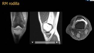 Anatomía RM Rodilla [upl. by Zeb612]