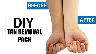 DIY Natural Ways To Get Rid Of Sun Tanned Skin Instantly At Home  DIY Home Remedies [upl. by Gneh]