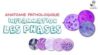 Anatomie Pathologique  Phases de lInflammation [upl. by Musser97]