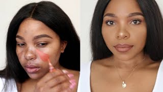 HOW TO COVER HYPERPIGMENTATION AND DARK SPOTS ON BROWN SKIN [upl. by Niraj175]