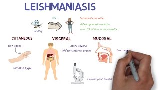 What is Leishmaniasis An introduction and overview [upl. by Rodavlas]