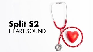 Fixed Split S2  Heart Sounds  MEDZCOOL [upl. by Ahseekan897]