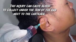 Bleeding And Bruising In the Ear Canal Haemoglobin Breakdown Explained [upl. by Dilaw610]