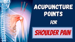 Acupuncture for Shoulder Injury shorts [upl. by Kirsten562]