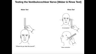 Interpreting the WeberRinne Tests EXPLAINED [upl. by Kessler194]