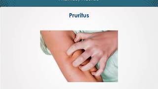 Pruritus  Dermatology  EduRx [upl. by Enial]