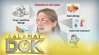 Salamat Dok Causes and symptoms of urticaria [upl. by Allekram]