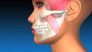 TMJ Explanation amp Therapy [upl. by Crowell374]